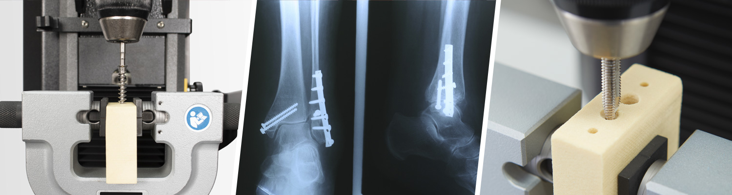 金屬醫用骨螺釘的 ASTM F543 測試方法